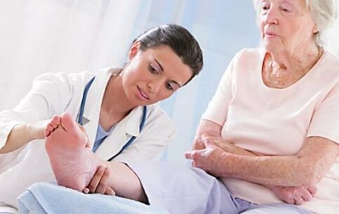 Consultar a un médico si tienes síntomas de venas varicosas.